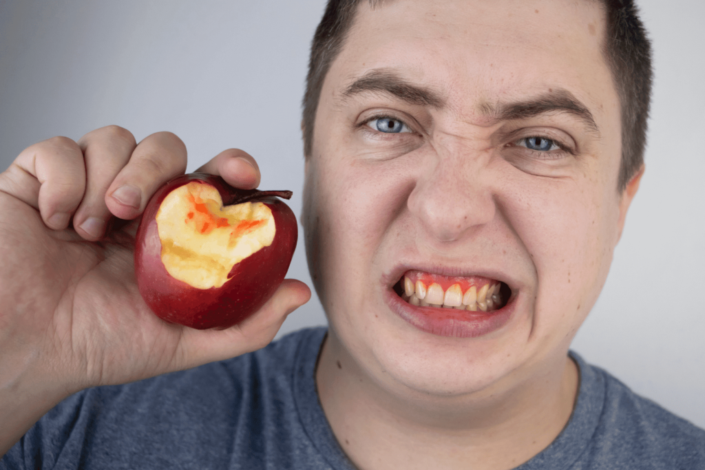 Bleeding Gums Causes and treatment and Prevention AlDoctor