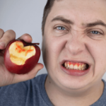 Bleeding Gums