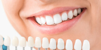 What Is Cosmetic Dentistry & Its Types?