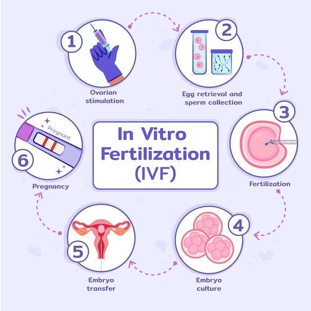 Infertility Treatment for Female A Comprehensive Guide to IVF for