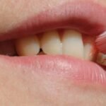 Golden Rules of Dental Hygiene in 2024