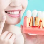 Dental Implants vs. Other Tooth Replacement Options: A Comprehensive Guide
