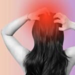 Scalp eczema causes and treatment